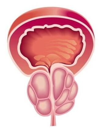Symptoms of prostatitis in men