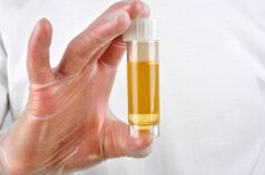 Urinalysis is one of the methods for diagnosing prostatitis